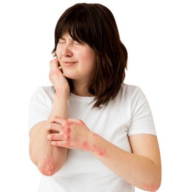 MILIA : CAUSES AND REMOVAL TREATMENT - Pure Skin Clinic