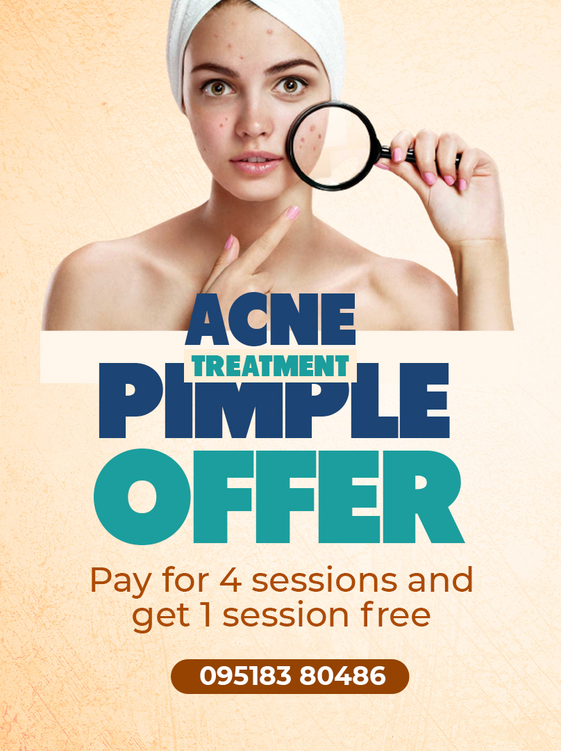 mobile banner acne pimple
